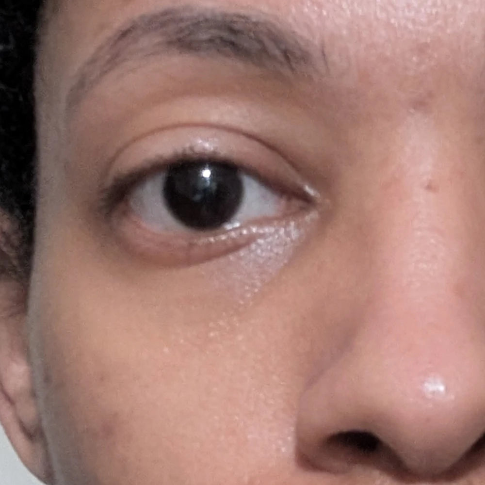 LaTia after 18 days of using Solawave LED mask