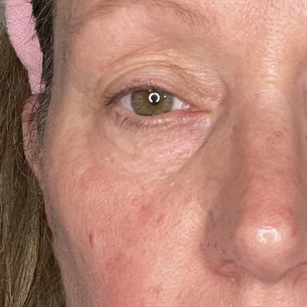 Alecia after 30 days, photo supplied by Solawave