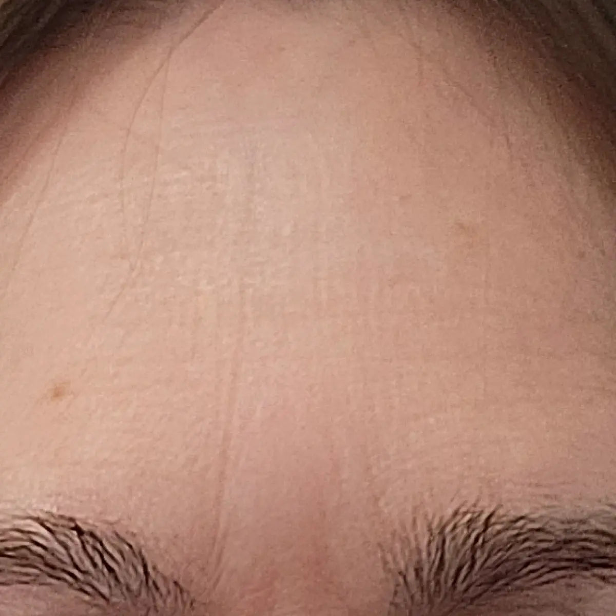 Tammy after 30 days, photo supplied by Solawave